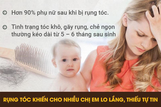 Bệnh rụng tóc hói đầu ở nữ giới do stress hoặc sau khhi sinh con